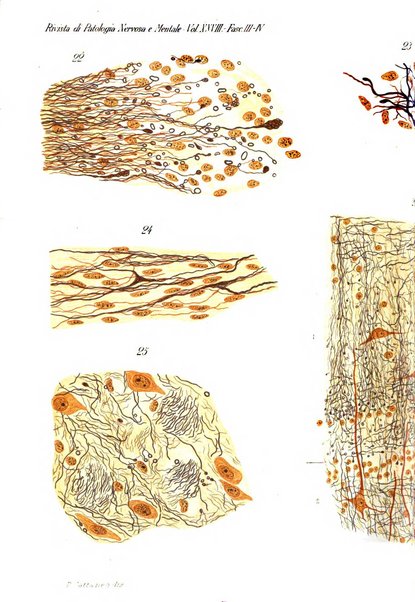 Rivista di patologia nervosa e mentale