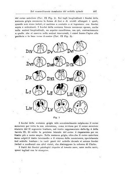 Rivista di patologia nervosa e mentale