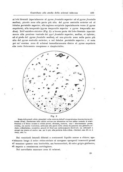 Rivista di patologia nervosa e mentale