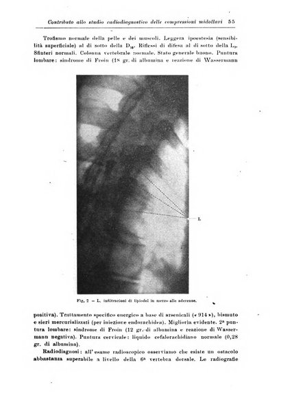 Rivista di patologia nervosa e mentale