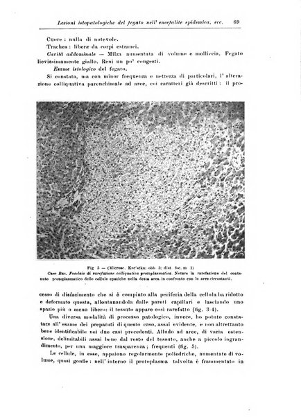 Rivista di patologia nervosa e mentale