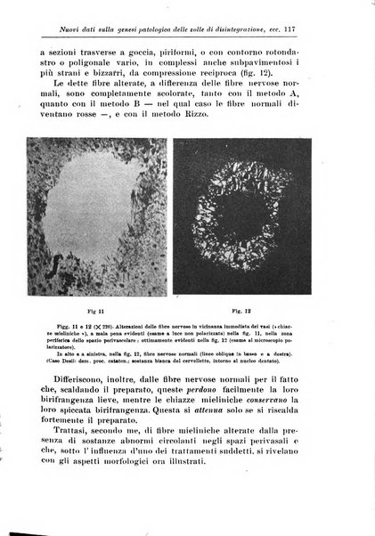 Rivista di patologia nervosa e mentale