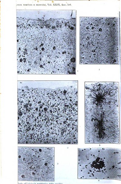 Rivista di patologia nervosa e mentale