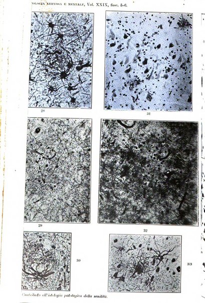 Rivista di patologia nervosa e mentale