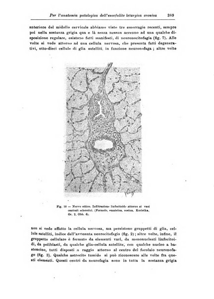 Rivista di patologia nervosa e mentale