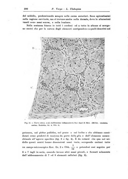 Rivista di patologia nervosa e mentale