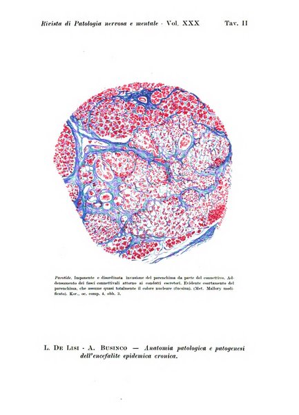 Rivista di patologia nervosa e mentale