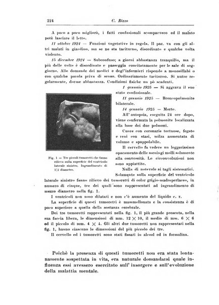 Rivista di patologia nervosa e mentale