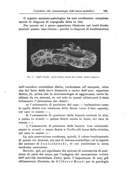 Rivista di patologia nervosa e mentale