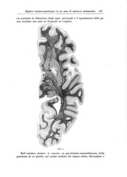 Rivista di patologia nervosa e mentale