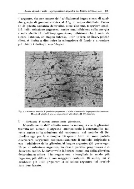 Rivista di patologia nervosa e mentale