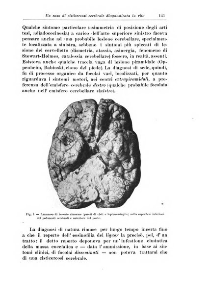 Rivista di patologia nervosa e mentale