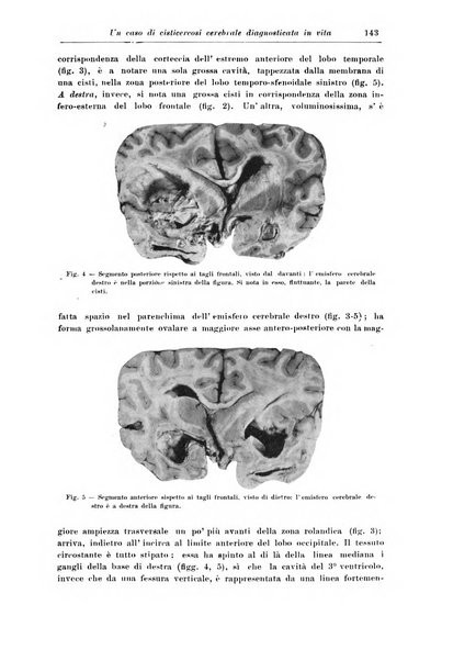 Rivista di patologia nervosa e mentale