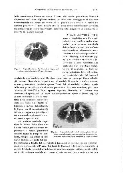 Rivista di patologia nervosa e mentale