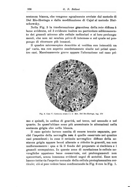 Rivista di patologia nervosa e mentale