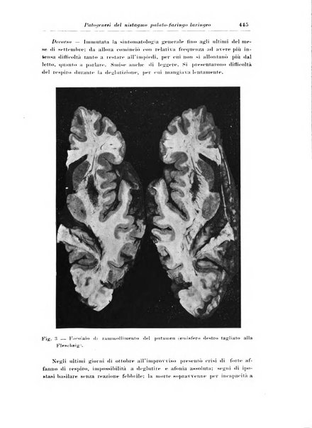 Rivista di patologia nervosa e mentale