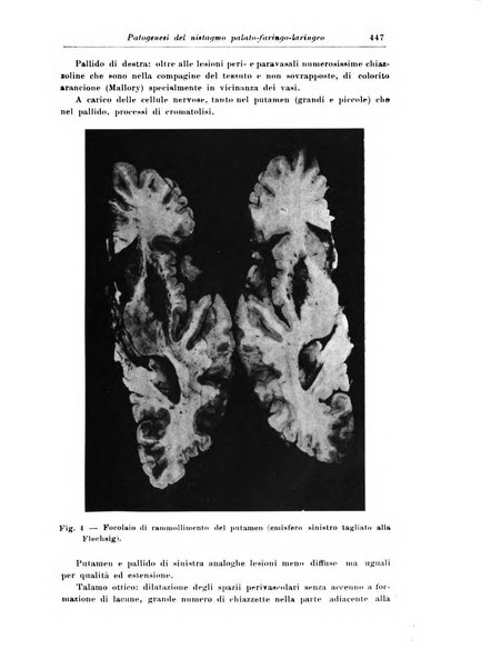 Rivista di patologia nervosa e mentale