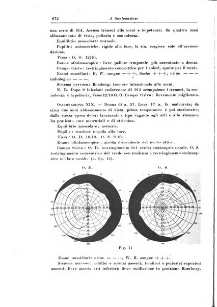 Rivista di patologia nervosa e mentale