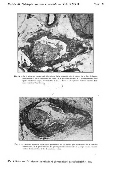 Rivista di patologia nervosa e mentale