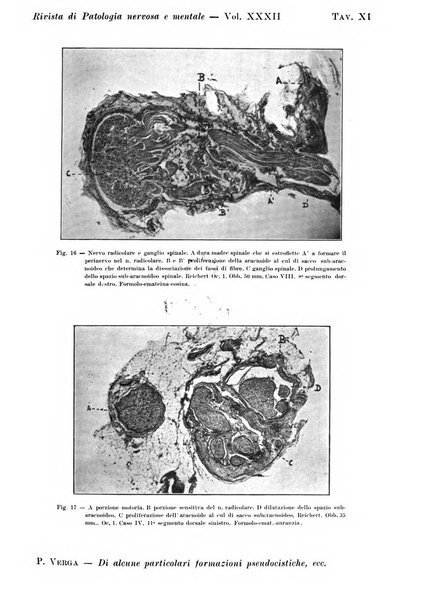 Rivista di patologia nervosa e mentale