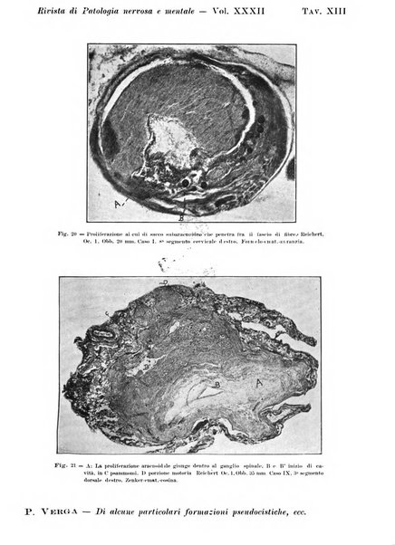 Rivista di patologia nervosa e mentale