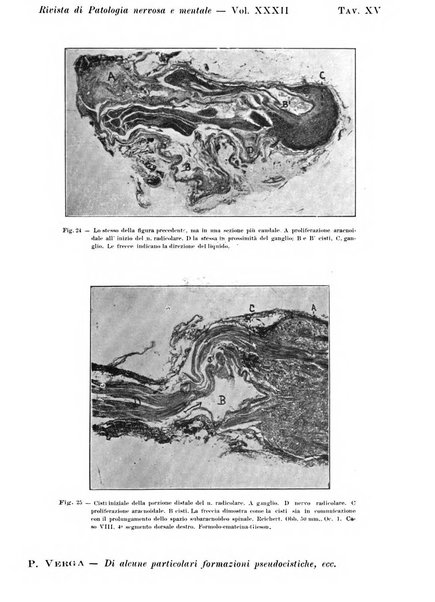 Rivista di patologia nervosa e mentale