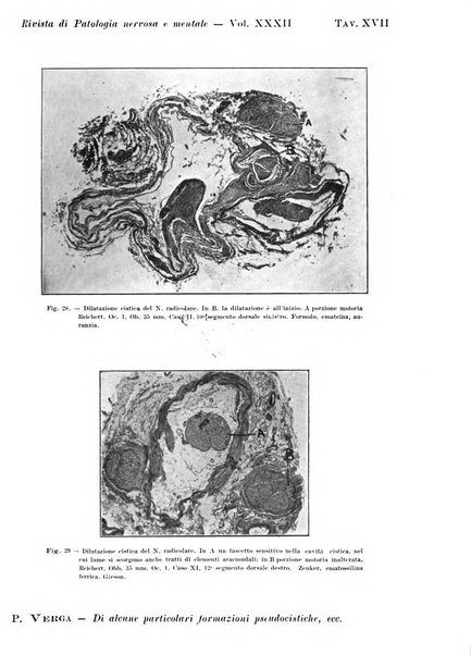 Rivista di patologia nervosa e mentale