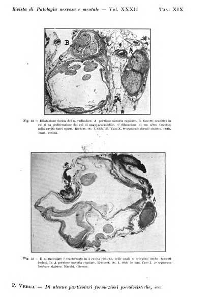 Rivista di patologia nervosa e mentale