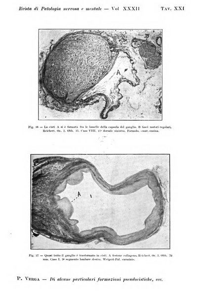 Rivista di patologia nervosa e mentale