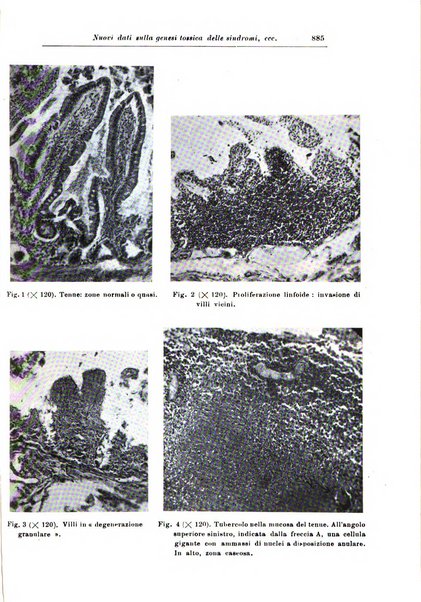 Rivista di patologia nervosa e mentale