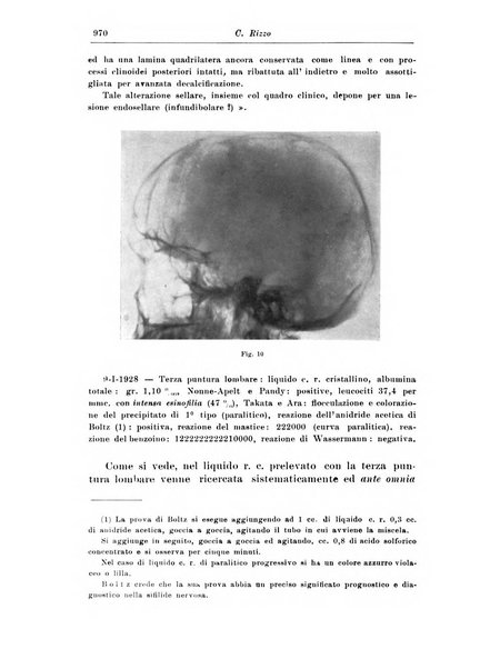 Rivista di patologia nervosa e mentale