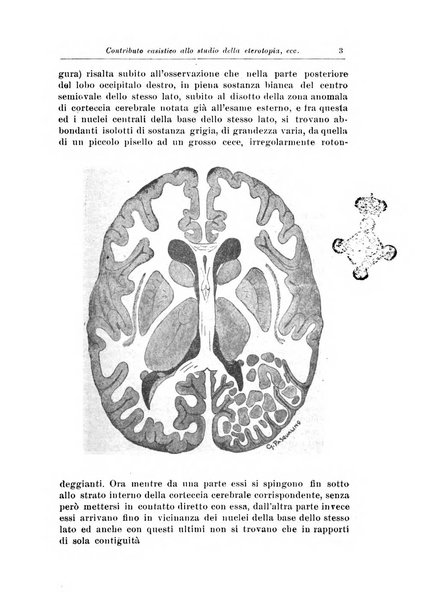 Rivista di patologia nervosa e mentale