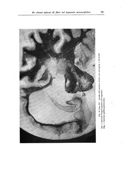 Rivista di patologia nervosa e mentale