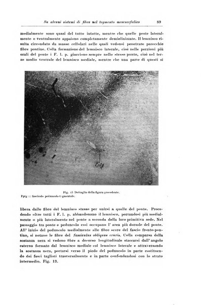 Rivista di patologia nervosa e mentale