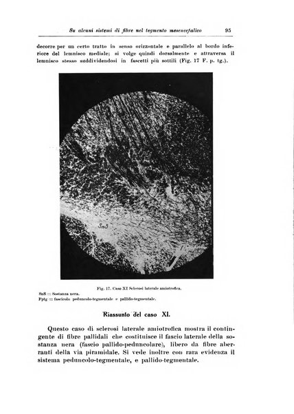 Rivista di patologia nervosa e mentale