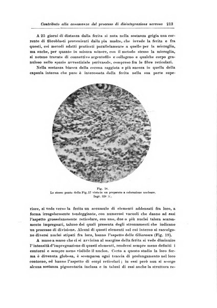 Rivista di patologia nervosa e mentale