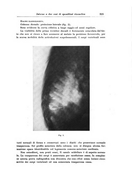 Rivista di patologia nervosa e mentale