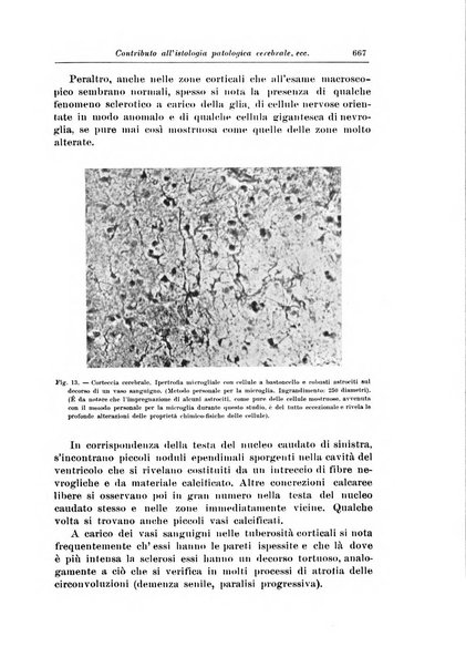 Rivista di patologia nervosa e mentale