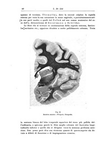 Rivista di patologia nervosa e mentale