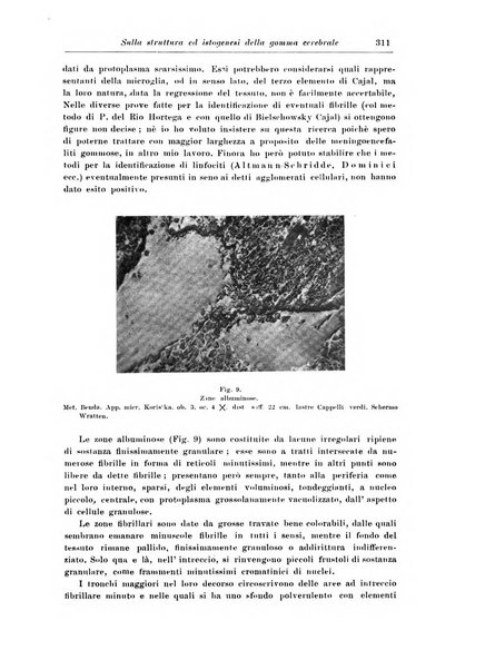 Rivista di patologia nervosa e mentale