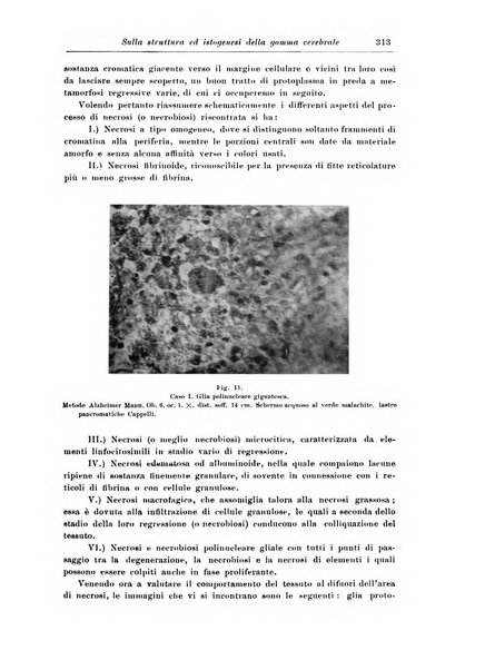 Rivista di patologia nervosa e mentale