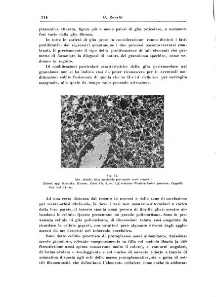 Rivista di patologia nervosa e mentale