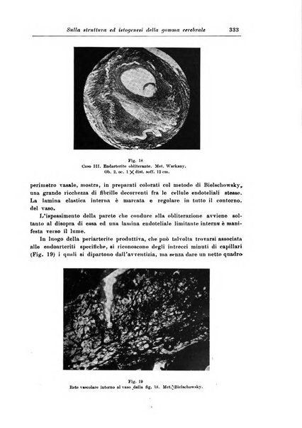 Rivista di patologia nervosa e mentale