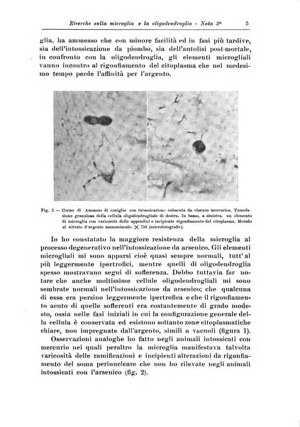 Rivista di patologia nervosa e mentale