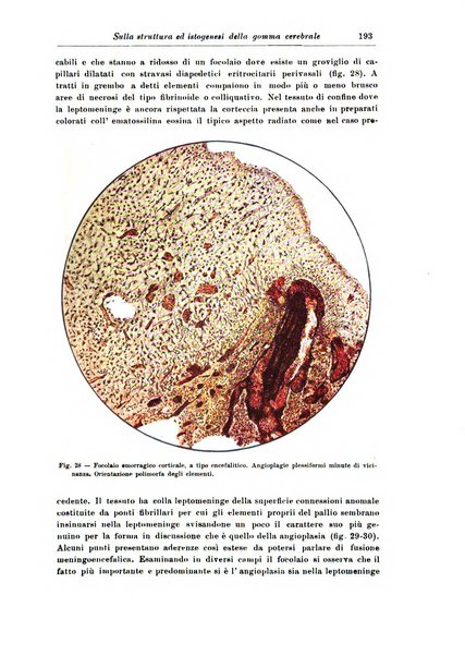 Rivista di patologia nervosa e mentale