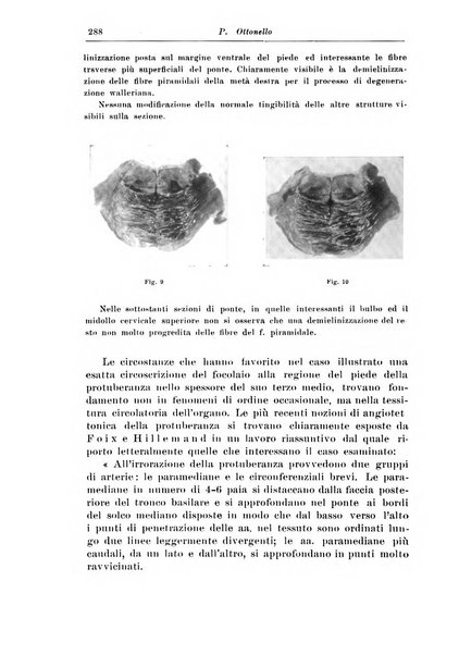 Rivista di patologia nervosa e mentale