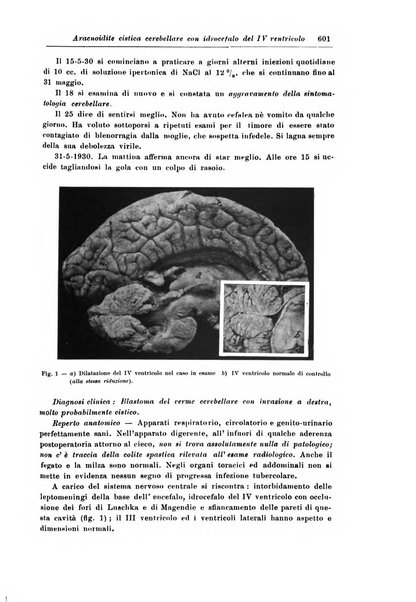 Rivista di patologia nervosa e mentale