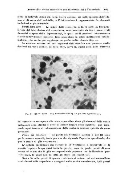 Rivista di patologia nervosa e mentale