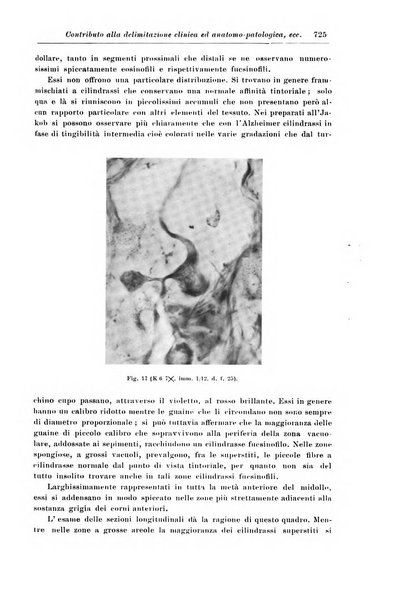 Rivista di patologia nervosa e mentale