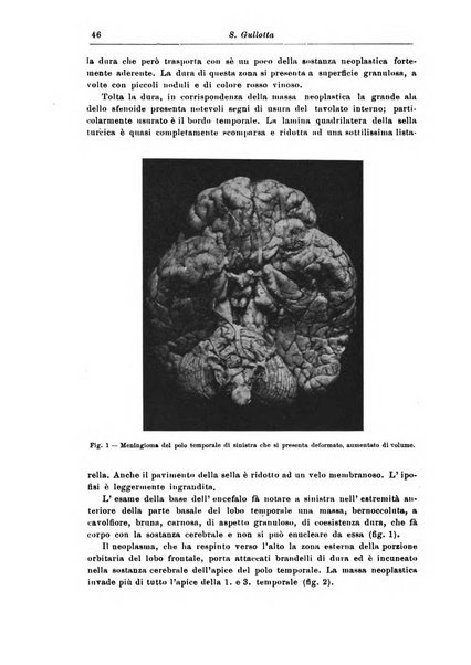 Rivista di patologia nervosa e mentale